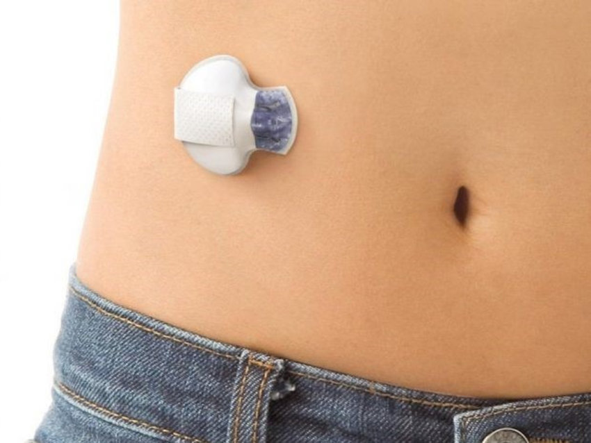 Medtronic Enlite